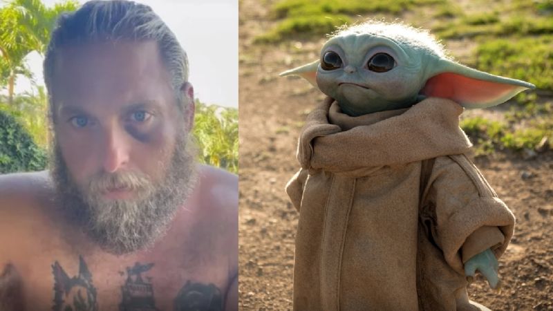 Jonah Hill aparece con un ojo morado y aclara que no fue a causa de su rencilla con Baby Yoda