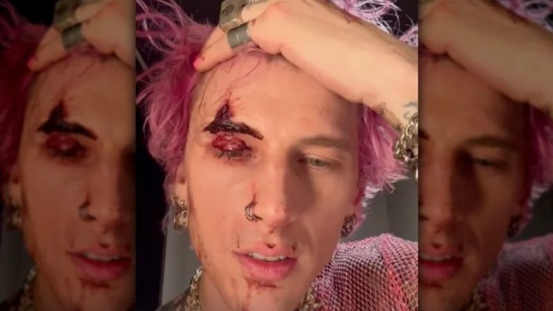 El comportamiento de Machine Gun Kelly escala a un nuevo nivel preocupante