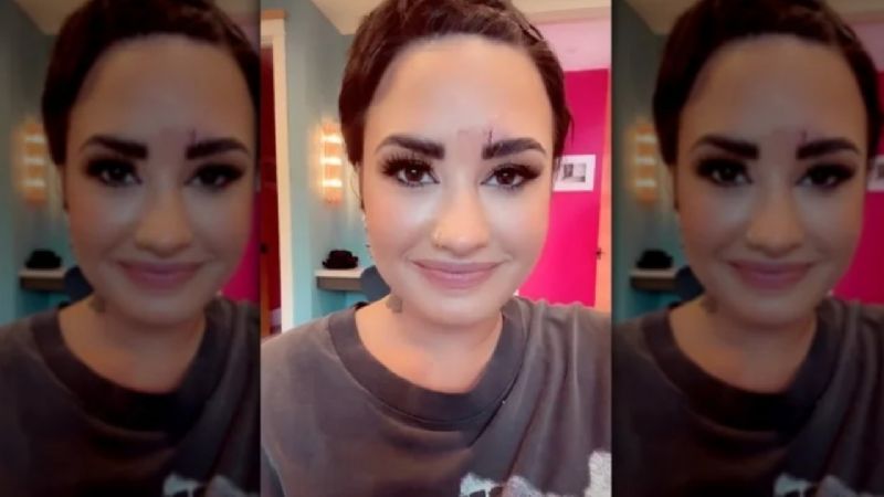 Demi Lovato acaba de sufrir una extraña lesión en el momento equivocado